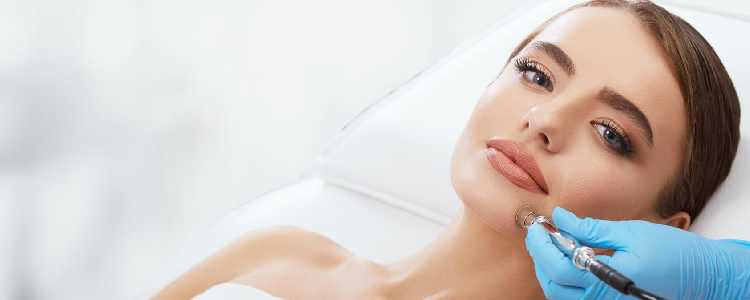 Microdermabrasion Treatment for Acne and Acne Scars