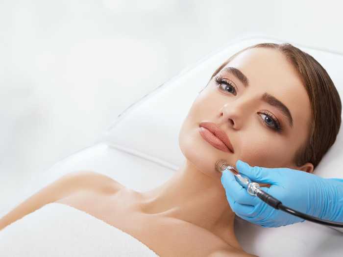 Microdermabrasion Treatment for Acne and Acne Scars
