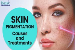Skin Pigment & Spots