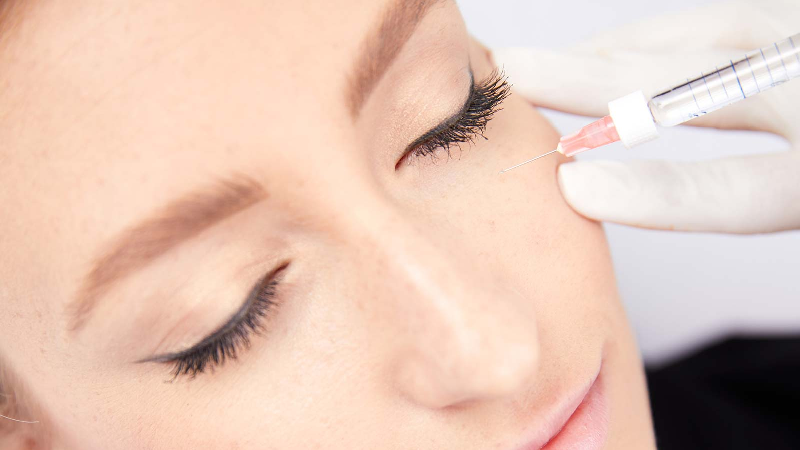 TOTAL FACE DERMAL FILLER TREATMENT or LIQUID FACELIFT