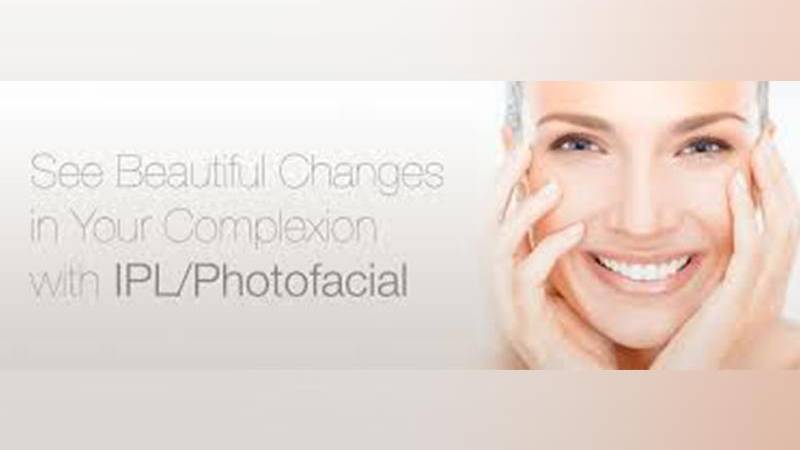 LASER PHOTOFACIAL REJUVENATION