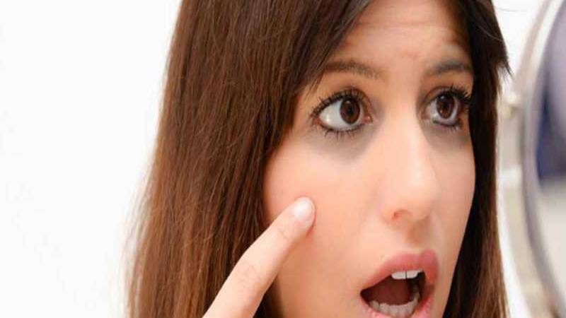 UNDER EYE DARK CIRCLES