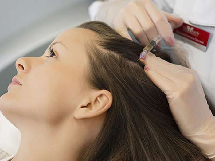 Hairfall